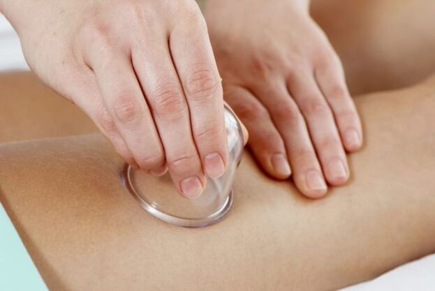 Cupping masaža za proširene vene
