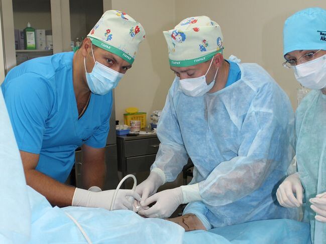 operacija proširenih vena