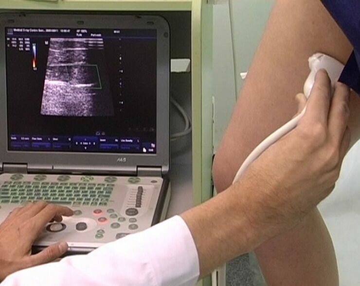 ultrazvučna dijagnoza proširenih vena zdjelice