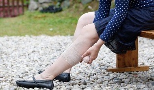 simptomi proširenih vena na nogama kod žena